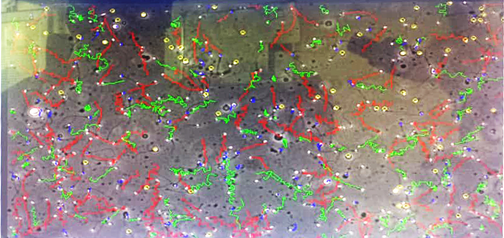 SCA Semen Analysis