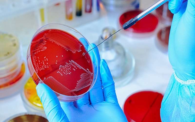 what is culture & antibiogram test?