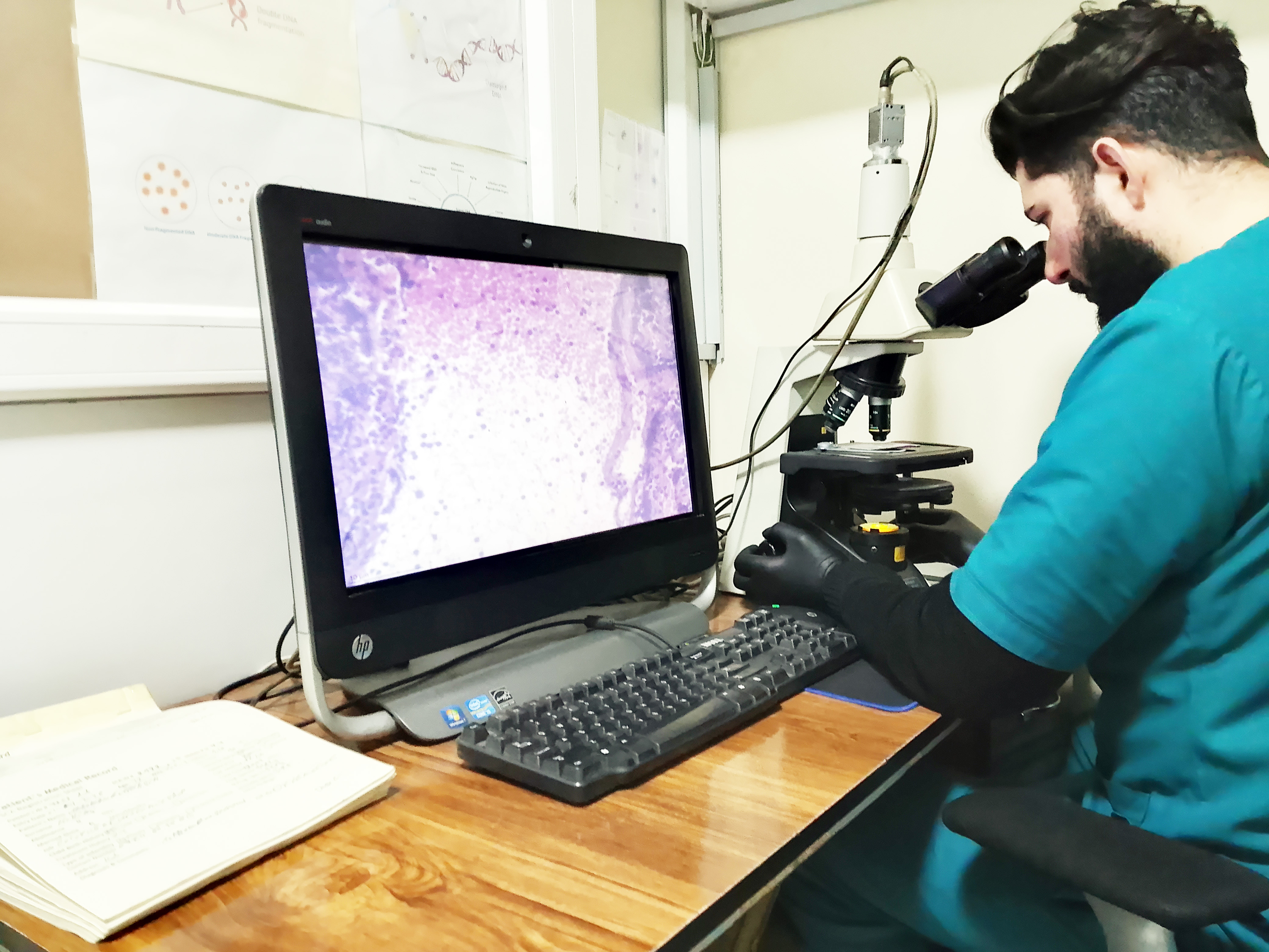 SCA- Semen Analysis